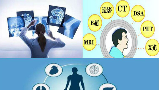 教你选择医学影像检查方式-医学影像原理与设备
